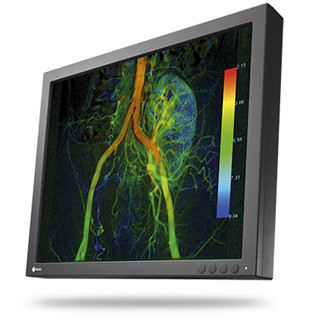 EIZO、X線透視画像を鮮明に表示できる19型手術室向けカラー液晶モニタ