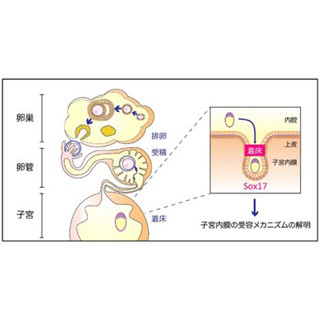 着床不全の母体側の原因はSox17遺伝子発現量の低下 - 東京医科歯科大など