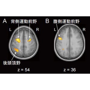 "左と右、どちらを先に触られたか"を判断するのは身体運動の脳領域 - 静大