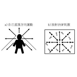 放射状方向の運動刺激が軽度認知機能障害の早期診断バイオマーカーに - 九大