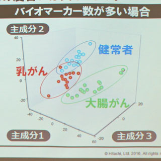 尿中の代謝物で健常者・乳がん患者・大腸がん患者を識別　- 日立らが開発したがん診断技術とは