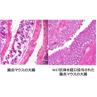 IgA抗体に悪玉菌の増殖を抑え腸炎を抑制する効果 - NAISTらがマウスで発見