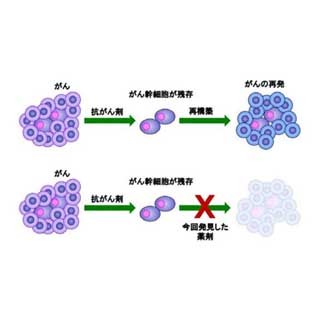 国がんなど、大腸がんの根元となるがん幹細胞を抑制する新規化合物を創出