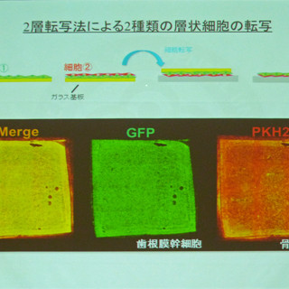 再生医療応用に期待 - TMDU、複数の細胞を積層化して移植する技術を開発