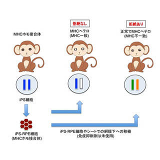 iPS細胞由来の網膜細胞を他家移植しても拒絶反応が起こらないサル - 理研