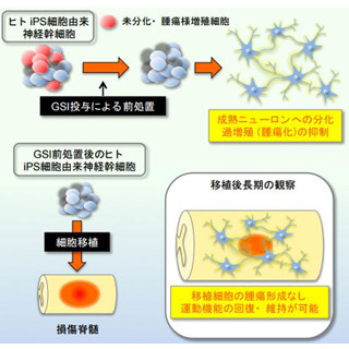 慶大、iPS細胞幹を用いた移植治療における腫瘍化を予防する方法を開発