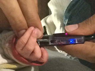 NEC、新生児/乳幼児向け指紋撮像機器の試作機を開発