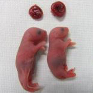 成体マウスのiPS細胞から卵子の作製に成功、健常なマウスに発生 - 九大