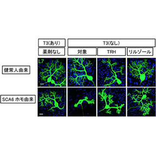 脊髄小脳変性症の患者からiPS細胞を樹立し、病態の一部を再現 - 理研