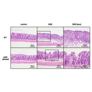 潰瘍性大腸炎やクローン病には「形質細胞様樹状細胞」が関与 - 宮崎大