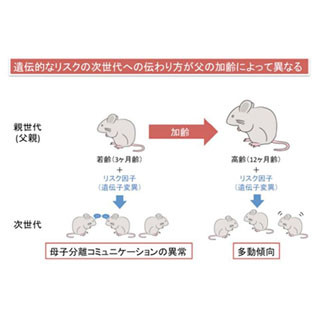 遺伝的リスクの次世代への伝わり方は、父親の加齢によって異なる - 東北大