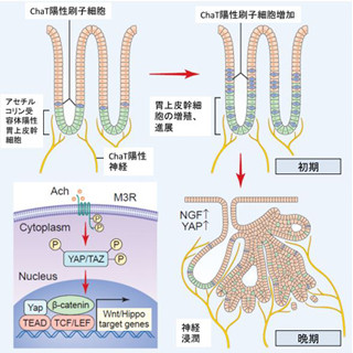 東大、神経ストレスが胃がんの発育を加速させるメカニズムを解明