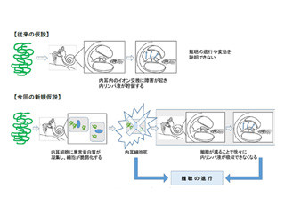 慶応大、iPS細胞を用いて遺伝性難聴「Pendred症候群」の原因を特定