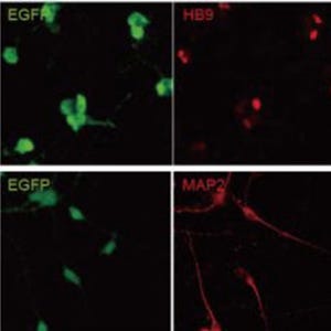 ES細胞/iPS細胞から脊髄運動ニューロンを簡便に作製する技術 - 京大CiRA
