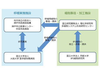 滲出型加齢黄斑変性に対する他家iPS細胞を用いた臨床研究を開始-理研など