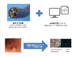 サイバネット、機械学習を用いた内視鏡診断システムの特許を取得