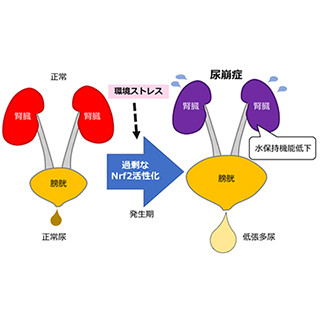 腎臓発生期におけるNrf2の過剰な活性化が腎性尿崩症を引き起こす - 東北大