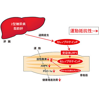 肝臓ホルモンが運動の効果を無効にする「運動抵抗性」を引き起こす - 金沢大