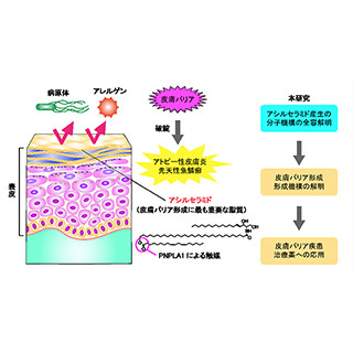 皮膚バリア形成に重要な脂質産生を解明-アトピー性皮膚炎治療薬開発に期待