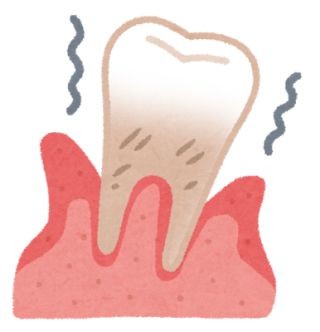 ハッカ油とカルバゾクロムが歯周組織再生に貢献 - ロート製薬