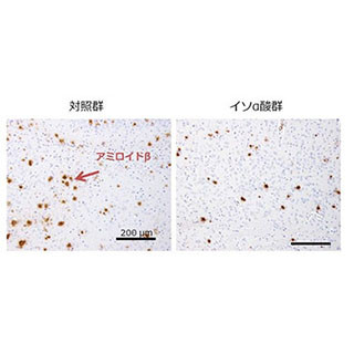 ビール苦味成分がアルツハイマー病の原因物質を減らし認知機能を改善 - 東大