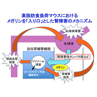 糖尿病性腎症の成因に基づく尿検査法を開発 - 新潟大学