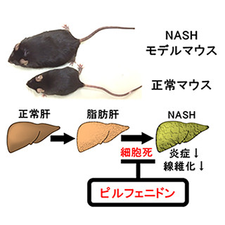 特発性肺線維症の治療薬が非アルコール性脂肪肝炎にも有効か - TMDUと九大