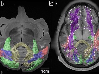 NICT、サルとヒトの視覚情報を伝える線維束の類似性をMRIIデータで発見