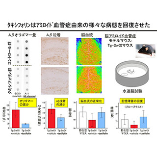 国循、アルツハイマー病発症の原因物質の蓄積を抑制する物質を発見