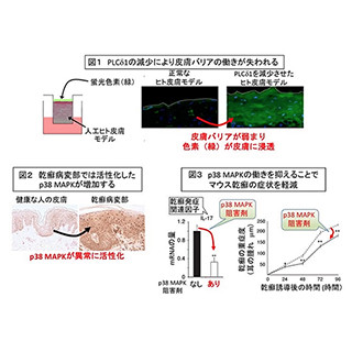 東京薬科大学、皮膚バリアの正常な働きに必要な脂質代謝酵素を発見