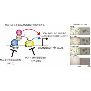 国がん、MLL遺伝子変異を伴う急性白血病の分子メカニズムを解明