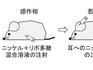 東北大、ニッケルアレルギー発症に関わるニッケル結合タンパク質を発見