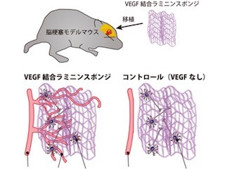 JSTなど、脳梗塞領域に血管を誘引するスポンジ形状の人工細胞足場を開発