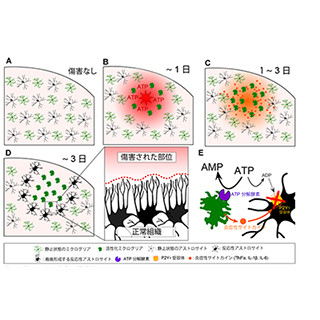 山梨大など、グリア細胞が外傷性脳損傷から脳を保護する仕組みを明らかに