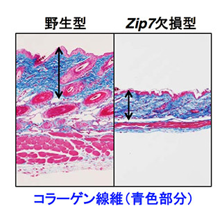 皮膚コラーゲン維持における亜鉛の役割を解明 - 加齢対策や疾患治療に期待