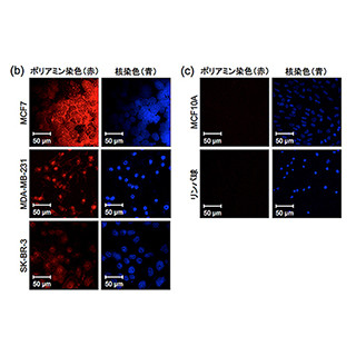 細胞内アミド化反応で、がん細胞を正常細胞と区別して見分けることに成功