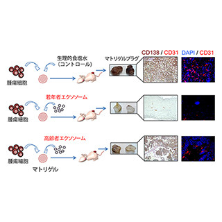 東京医科大学、エクソソームを「若返えらせる」ことにより血液のがんを抑制