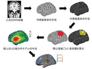 富山大など、後頭葉の脳回形成の変化が統合失調症発症を予測することを解明