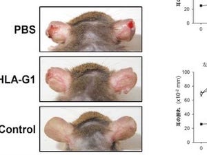 北大、HLA-G1タンパク質の過剰な免疫反応による慢性炎症の治療効果を発見
