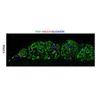 膵芽細胞への分化を制御するメカニズムに細胞骨格関連分子が関与 - 京大