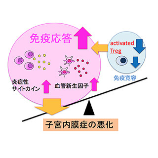 京都府立医科大、子宮内膜症の進展機序を解明