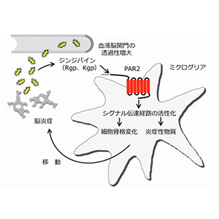 九大、歯周病菌の出す酵素がアルツハイマー病型認知症の悪化に関与と解明