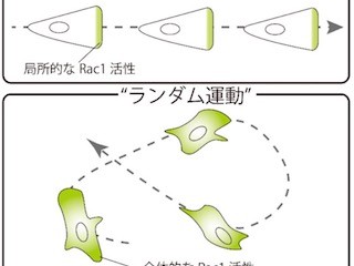 がん転移の解明に前進-千葉大、細胞運動を抑える新たな分子メカニズム発見