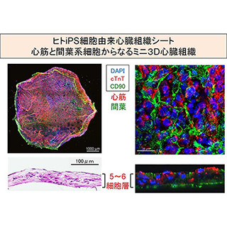京大、ヒトiPS細胞由来の3次元的心臓組織を作製し致死性不整脈の特徴を再現