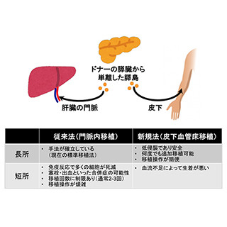 東北大学、糖尿病治療のための簡便・安全・効果的な膵島移植法の開発に成功