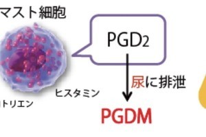 東大、食物アレルギーの尿中バイオマーカーを発見- 免疫療法の開発指標に