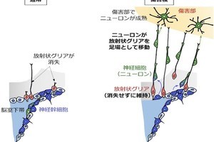 新生児期に存在する脳障害後の神経再生メカニズムを発見