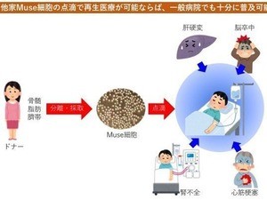 ドナーMuse細胞を用いた心筋梗塞の修復再生治療法の開発に期待