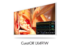 EIZO、49型の手術室向け画像表示モニター「CuratOR LX491W」を発売