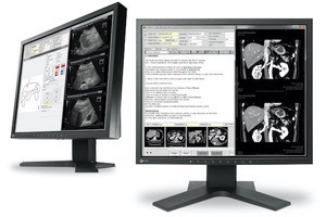 EIZO、19型画面の電子カルテ画像表示モニター「RadiForce MX194」を6月発売